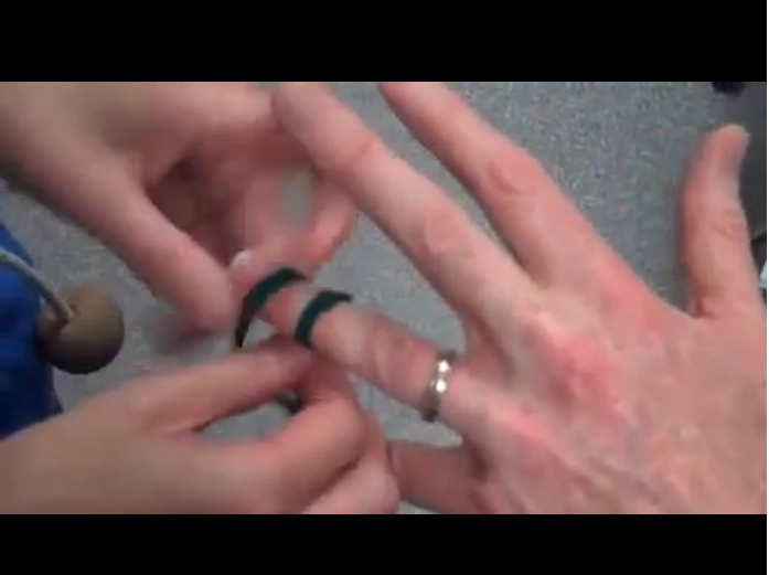 Iata cat de usor poti scoate un inel ce ti-a ramas blocat pe deget ! VIDEO